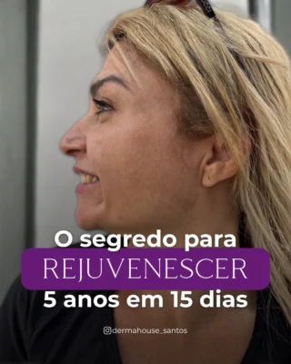 Derma House — tratamento estético